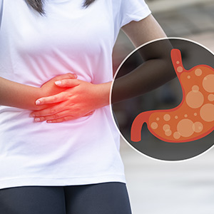ACID Reflux (GERD) Treatment in Bolingbrook, Palatine, and East Dundee IL
