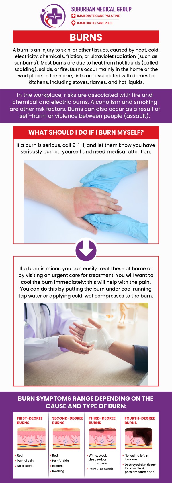Common questions asked by patients: What are the most common causes of burns? How are first-degree, second-degree, and third-degree burns different? When should you seek medical care for a burn injury? What is the proper first aid treatment for minor burns? For more information, contact us or book an appointment online. We are conveniently located at 693 W Boughton Rd, Bolingbrook, IL 60440. We serve patients from Bolingbrook IL, Romeoville IL, Naperville IL, and Woodridge IL, and surrounding cities. Common questions asked by patients: What are the most common causes of burns? How are first-degree, second-degree, and third-degree burns different? When should you seek medical care for a burn injury? What is the proper first aid treatment for minor burns? For more information, contact us or book an appointment online. We are conveniently located at 693 W Boughton Rd, Bolingbrook, IL 60440. We serve patients from Bolingbrook IL, Romeoville IL, Naperville IL, and Woodridge IL, and surrounding cities.