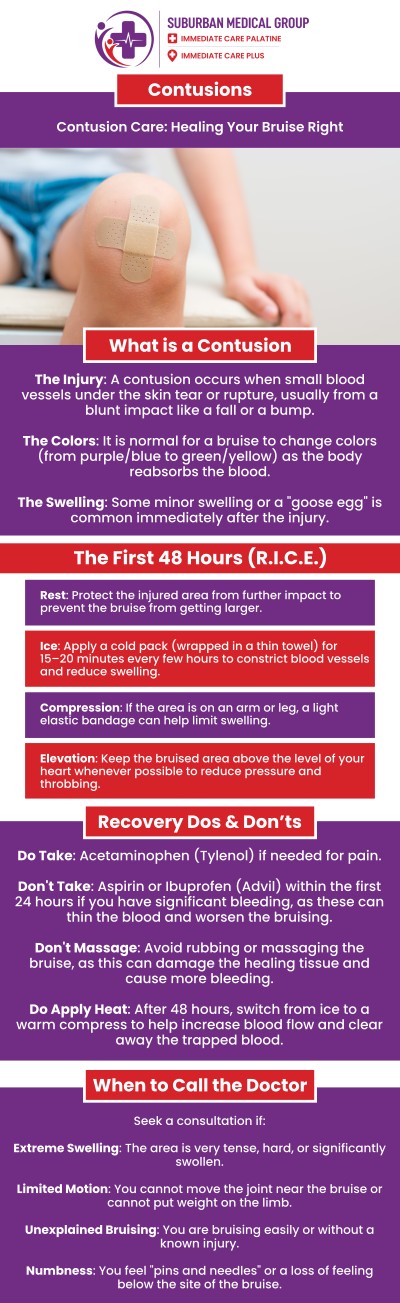 Common questions asked by patients: What is a contusion and how does it occur? What are the common symptoms of a contusion injury? How long does it take for a contusion to heal? When should you see a doctor for a severe bruise or contusion? For more information, contact us or book an appointment online. We are located at 371 W Northwest Hwy, Palatine, IL 60067. We serve patients from Palatine IL, Rolling Meadows IL, Arlington Heights IL, Mount Prospect IL, and surrounding cities.