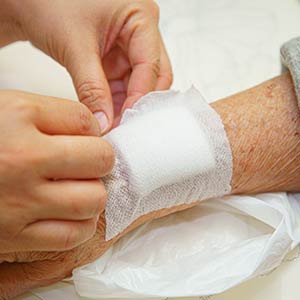 Cuts and Lacerations Treatment in Bolingbrook, Palatine, and East Dundee IL