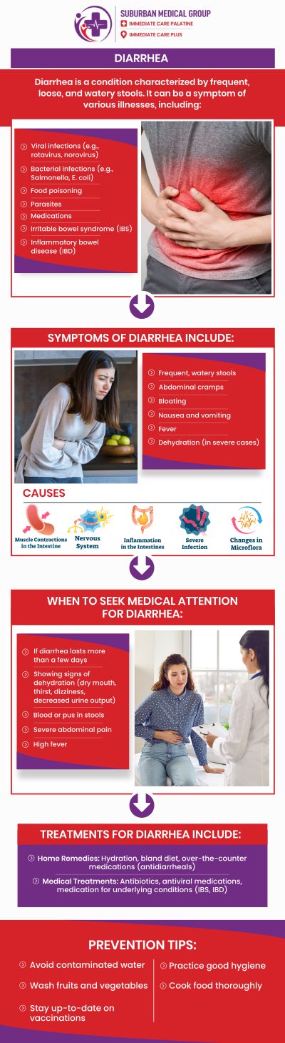 Common questions asked by patients: What are the most common causes of diarrhea? When does diarrhea require medical attention? How long does acute diarrhea usually last? Can dehydration occur due to diarrhea, and how can it be prevented? What foods should be avoided during diarrhea symptoms? For more information, contact us or book an appointment online. We are conveniently located at 693 W Boughton Rd, Bolingbrook, IL 60440. We serve patients from Bolingbrook IL, Romeoville IL, Naperville IL, and Woodridge IL, and surrounding cities. Common questions asked by patients: What are the most common causes of diarrhea? When does diarrhea require medical attention? How long does acute diarrhea usually last? Can dehydration occur due to diarrhea, and how can it be prevented? What foods should be avoided during diarrhea symptoms? For more information, contact us or book an appointment online. We are conveniently located at 693 W Boughton Rd, Bolingbrook, IL 60440. We serve patients from Bolingbrook IL, Romeoville IL, Naperville IL, and Woodridge IL, and surrounding cities.