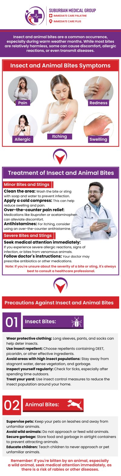 For more information book an appointment online or contact us. We have convenient locations to serve you in Bolingbrook, IL, Palatine, IL and East Dundee, IL. For more information book an appointment online or contact us. We have convenient locations to serve you in Bolingbrook, IL, Palatine, IL and East Dundee, IL.