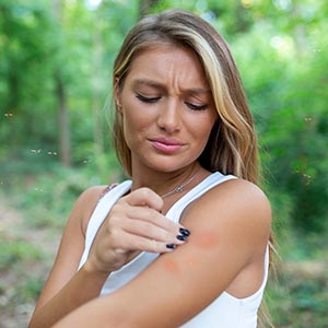 Insect Bites Treatment in Bolingbrook, Palatine, and East Dundee IL
