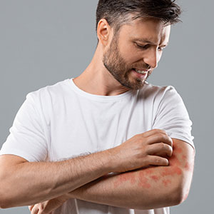 Rashes Treatment in Bolingbrook, Palatine, and East Dundee IL