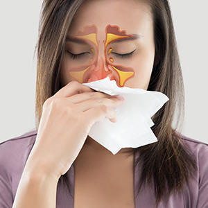 Sinus Infections Treatment in Bolingbrook, Palatine, and East Dundee IL