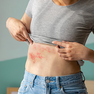 Minor Skin Infections Treatment in Bolingbrook, Palatine, and East Dundee IL
