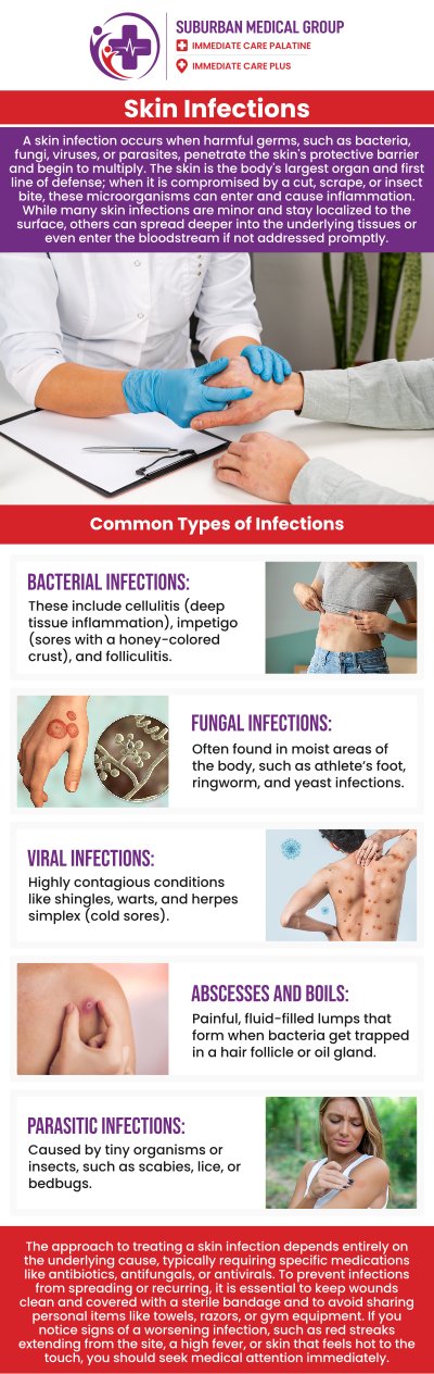 Common questions asked by patients: What are the common signs of a minor skin infection? Can a minor skin infection heal on its own without treatment? When should I see a doctor for a skin infection? What causes minor skin infections like boils or cellulitis? For more information, contact us or book an appointment online. We are located at 371 W Northwest Hwy, Palatine, IL 60067. We serve patients from Palatine IL, Rolling Meadows IL, Arlington Heights IL, Mount Prospect IL, and surrounding cities.