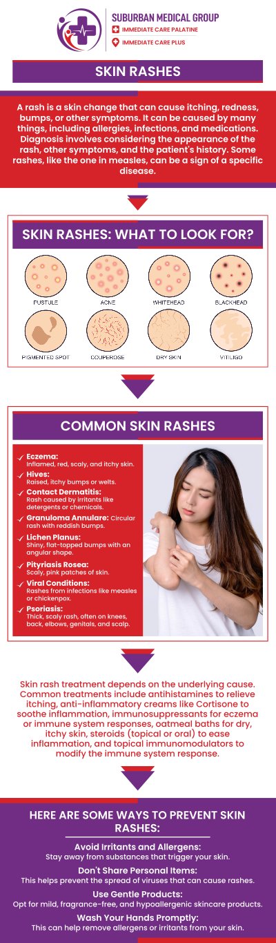 Common questions asked by patients: What are the common causes of skin rashes? How can l identify what type of rash I have? When should I seek medical attention for a rash? What treatments are available for skin rashes? For more information, contact us or book an appointment online. We are located at 371 W Northwest Hwy, Palatine, IL 60067. We serve patients from Palatine IL, Rolling Meadows IL, Arlington Heights IL, Mount Prospect IL, and surrounding cities. Common questions asked by patients: What are the common causes of skin rashes? How can l identify what type of rash I have? When should I seek medical attention for a rash? What treatments are available for skin rashes? For more information, contact us or book an appointment online. We are located at 371 W Northwest Hwy, Palatine, IL 60067. We serve patients from Palatine IL, Rolling Meadows IL, Arlington Heights IL, Mount Prospect IL, and surrounding cities.