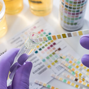 Urinalysis in Bolingbrook, Palatine, and East Dundee IL
