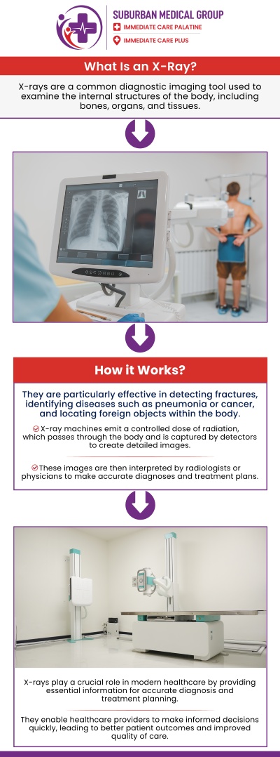 Common questions asked by patients: What conditions can be diagnosed using on-site X-rays? How quickly are on-site X-ray results available during a visit? Are on-site X-rays safe for children and adults? Do I need an appointment for on-site X-rays at urgent care? For more information, contact us or book an appointment online. We are conveniently located at 888 E Main St, East Dundee, IL 60118. We serve patients from East Dundee IL, West Dundee IL, Sleepy Hollow IL, Gilberts IL, and surrounding cities. Common questions asked by patients: What conditions can be diagnosed using on-site X-rays? How quickly are on-site X-ray results available during a visit? Are on-site X-rays safe for children and adults? Do I need an appointment for on-site X-rays at urgent care? For more information, contact us or book an appointment online. We are conveniently located at 888 E Main St, East Dundee, IL 60118. We serve patients from East Dundee IL, West Dundee IL, Sleepy Hollow IL, Gilberts IL, and surrounding cities.