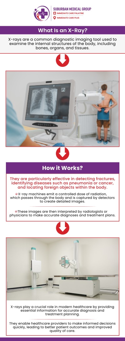Accurate diagnostics are the vital foundation of effective medical treatment, especially when you are dealing with acute pain or sudden physical trauma. By utilizing advanced onsite X-rays at our Immediate Care facility, our experienced providers can instantly visualize internal structures to identify or rule out severe injuries confidently. This seamless integration of high-quality imaging directly into your appointment ensures you receive a precise diagnosis and prompt medical intervention without the stress of prolonged wait times. For more information, contact us or book an appointment online. We are located at 371 W Northwest Hwy, Palatine, IL 60067.